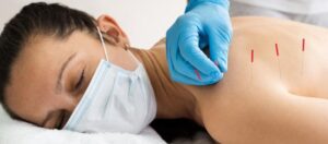 Kuru İğne Tedavisi Nedir? Nasıl Yapılır?