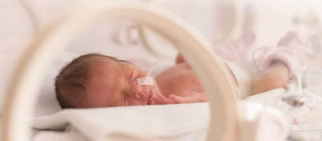 Yenidoğan Bebekte Solunum Sıkıntısı