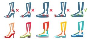 Yüksek Topuklu ve Babet Ayakkabıların Yol Açtığı Rahatsızlıklar